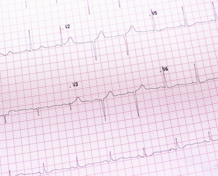 EKG Appointment Near Brooklyn