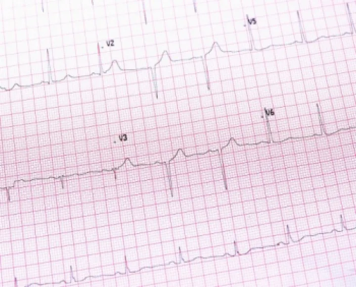 EKG/ECG lab testing Brooklyn 